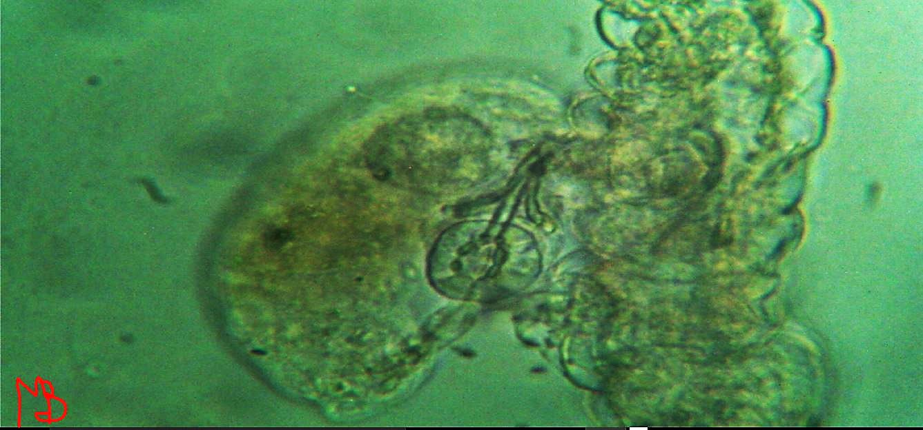 una, ritengo ,rarit� al microscopio:Tardigrado morto e ciliato banchetta